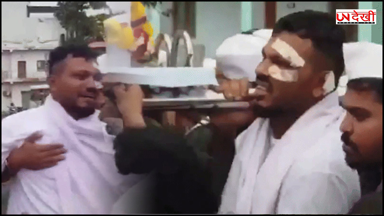 आज बेइंतहा दर्द में अहमदाबाद विमान हादसे में बचे विश्वास, भाई को दिया कंधा