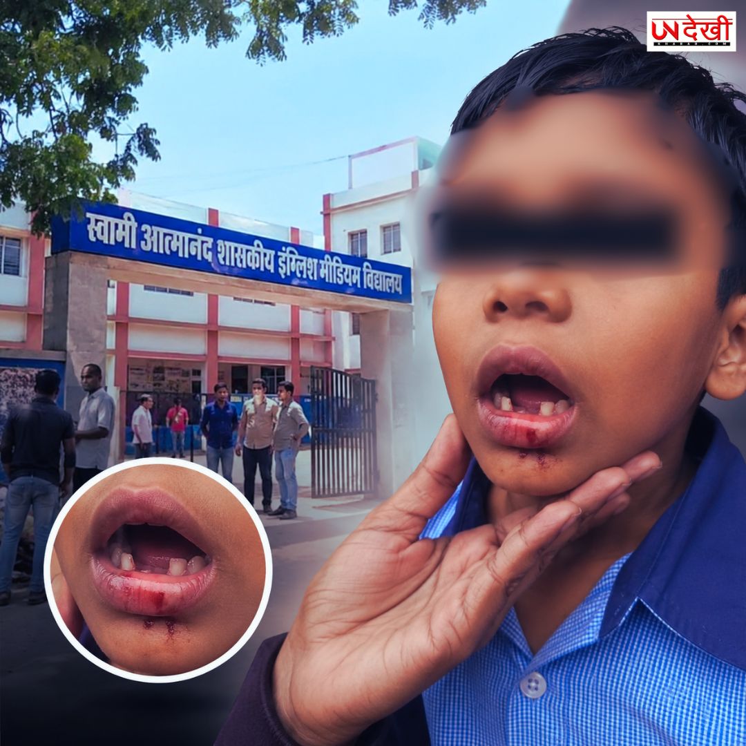टीचर की पिटाई या हैवानियत? तीसरी के मासूम के टूटे 3 दांत, जबड़ा भी फटा