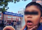 टीचर की पिटाई या हैवानियत? तीसरी के मासूम के टूटे 3 दांत, जबड़ा भी फटा